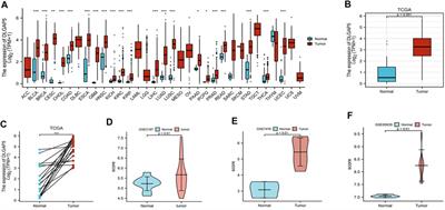 NEAT1/MALAT1/XIST/PKD--Hsa-Mir-101-3p--DLGAP5 Axis as a Novel Diagnostic and Prognostic Biomarker Associated With Immune Cell Infiltration in Bladder Cancer